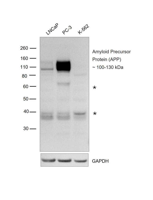 beta Amyloid Antibody in Western Blot (WB)