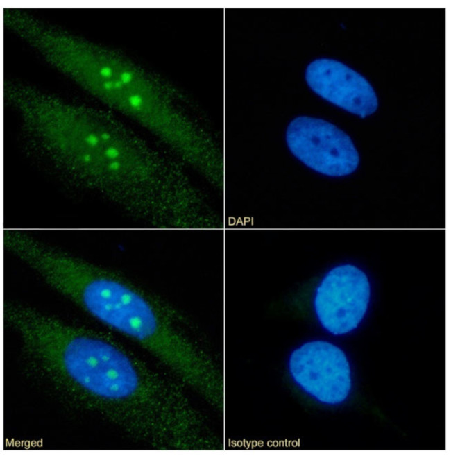 RRM2 Antibody in Immunocytochemistry (ICC/IF)