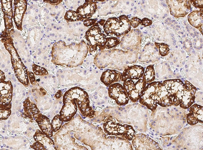 CDH16 Antibody in Immunohistochemistry (Paraffin) (IHC (P))
