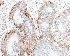 Carbonic Anhydrase IX Antibody in Immunohistochemistry (Paraffin) (IHC (P))