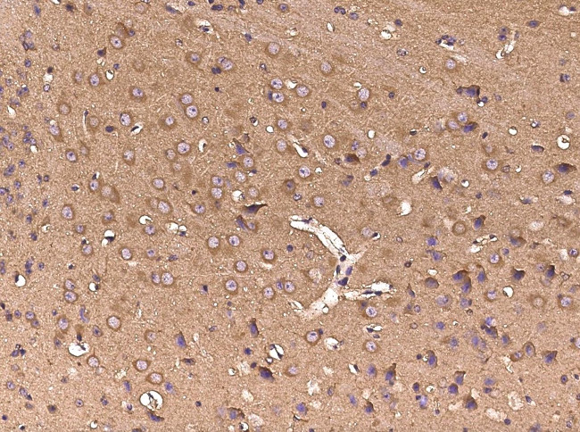 GP130 Antibody in Immunohistochemistry (Paraffin) (IHC (P))