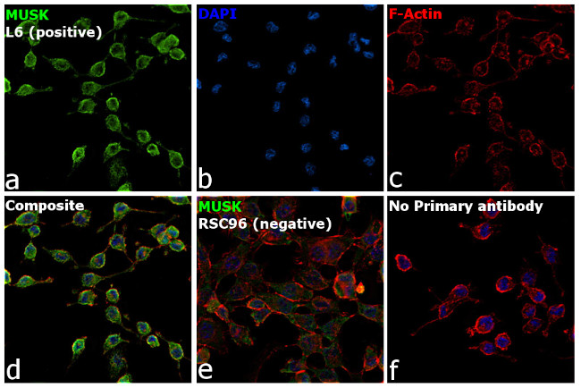 MUSK Antibody in Immunocytochemistry (ICC/IF)