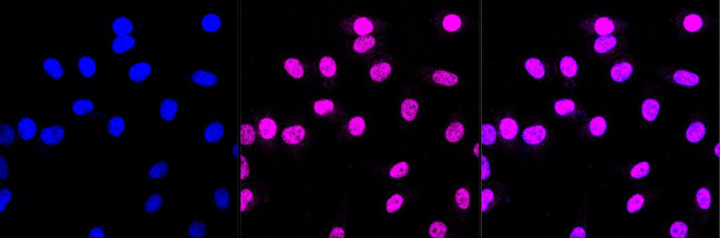 PRP8 Antibody in Immunocytochemistry (ICC/IF)