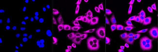 USP9X Antibody in Immunocytochemistry (ICC/IF)