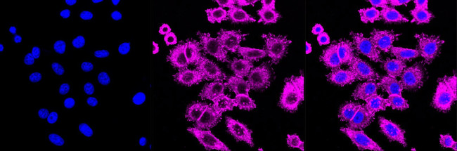 IQGAP1 Antibody in Immunocytochemistry (ICC/IF)