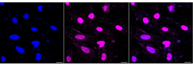 DNMT3A Antibody in Immunocytochemistry (ICC/IF)