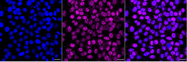 FosB Antibody in Immunocytochemistry (ICC/IF)