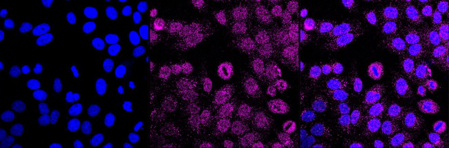 INPP4B Antibody in Immunocytochemistry (ICC/IF)