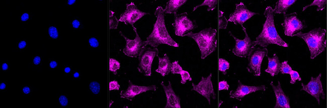 IRF7 Antibody in Immunocytochemistry (ICC/IF)