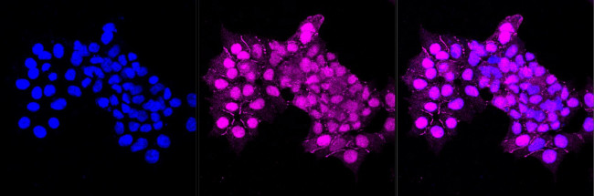MCAK Antibody in Immunocytochemistry (ICC/IF)
