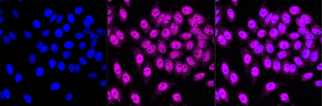 MCM4 Antibody in Immunocytochemistry (ICC/IF)