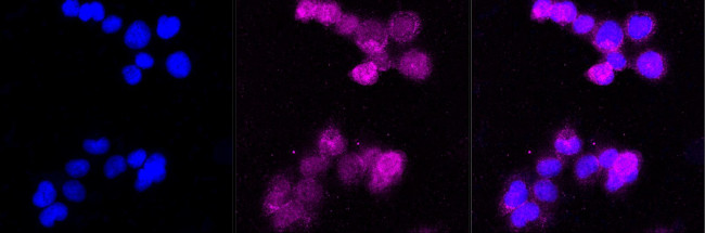 CD8 alpha Antibody in Immunocytochemistry (ICC/IF)