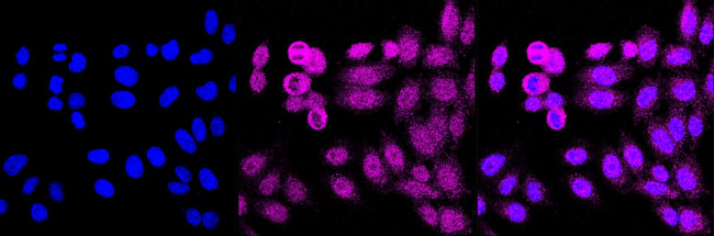 GAPDH Antibody in Immunocytochemistry (ICC/IF)