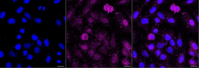 Cathepsin H Antibody in Immunocytochemistry (ICC/IF)