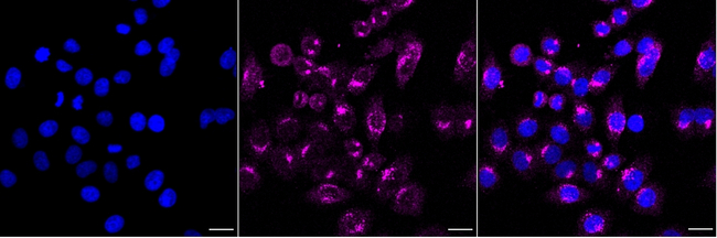 CHM Antibody in Immunocytochemistry (ICC/IF)