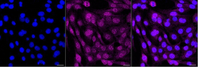 AKT Pan Antibody in Immunocytochemistry (ICC/IF)