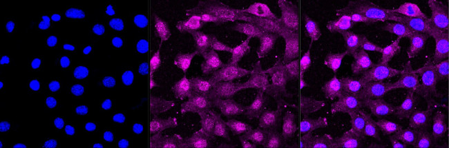 AKT Pan Antibody in Immunocytochemistry (ICC/IF)