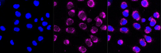 CDC25B Antibody in Immunocytochemistry (ICC/IF)