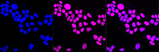 DDX17 Antibody in Immunocytochemistry (ICC/IF)