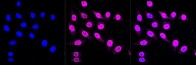alpha COP Antibody in Immunocytochemistry (ICC/IF)