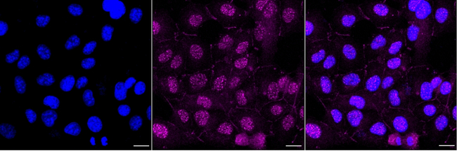 CHD1L Antibody in Immunocytochemistry (ICC/IF)