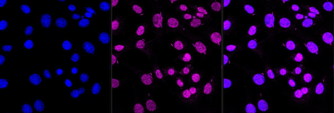 DDAH2 Antibody in Immunocytochemistry (ICC/IF)