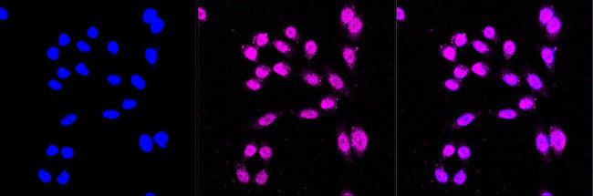 ALDH1A2 Antibody in Immunocytochemistry (ICC/IF)