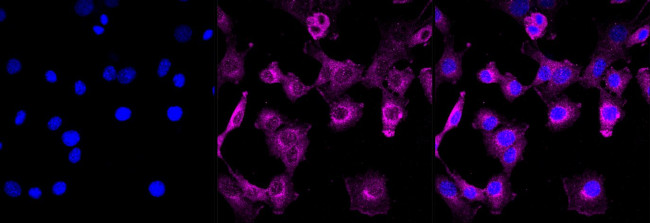 eIF3b Antibody in Immunocytochemistry (ICC/IF)