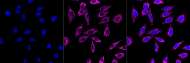 CLPX Antibody in Immunocytochemistry (ICC/IF)