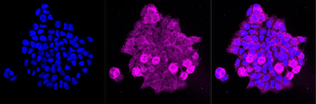 DCAF7 Antibody in Immunocytochemistry (ICC/IF)