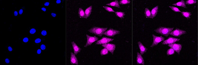 DAPK1 Antibody in Immunocytochemistry (ICC/IF)
