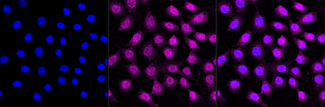 Biglycan Antibody in Immunocytochemistry (ICC/IF)