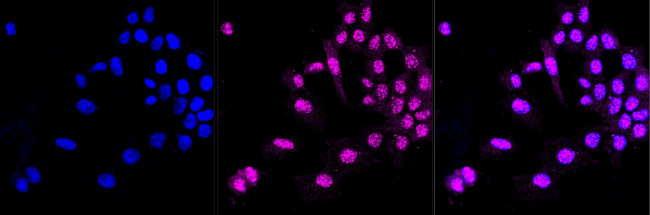 CTH Antibody in Immunocytochemistry (ICC/IF)