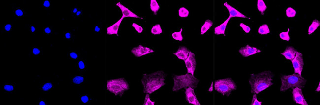 Aconitase 1 Antibody in Immunocytochemistry (ICC/IF)