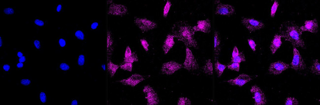 ATRIP Antibody in Immunocytochemistry (ICC/IF)