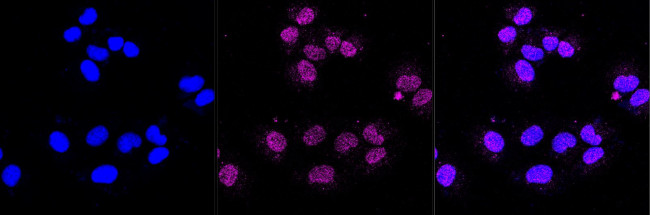 PSMB9 Antibody in Immunocytochemistry (ICC/IF)