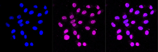 SCIN Antibody in Immunocytochemistry (ICC/IF)