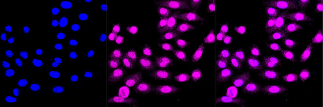 TRAPPC2 Antibody in Immunocytochemistry (ICC/IF)