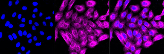 MRP2 Antibody in Immunocytochemistry (ICC/IF)