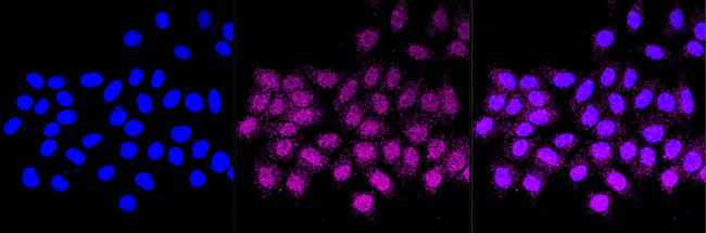 Tartrate Resistant Acid Phosphatase Antibody in Immunocytochemistry (ICC/IF)