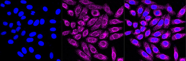 Acrosomal Vesicle Protein Antibody in Immunocytochemistry (ICC/IF)