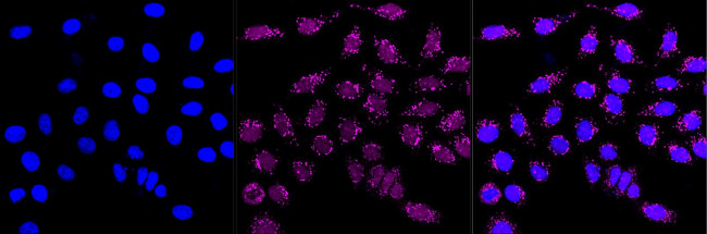 ATF1 Antibody in Immunocytochemistry (ICC/IF)