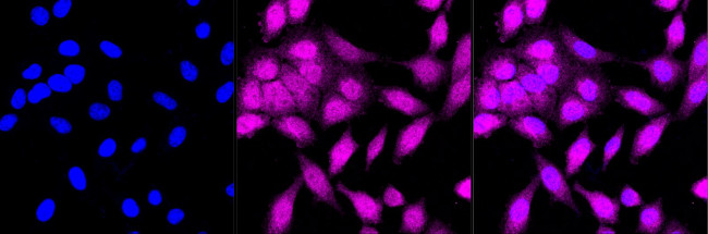 BAG2 Antibody in Immunocytochemistry (ICC/IF)