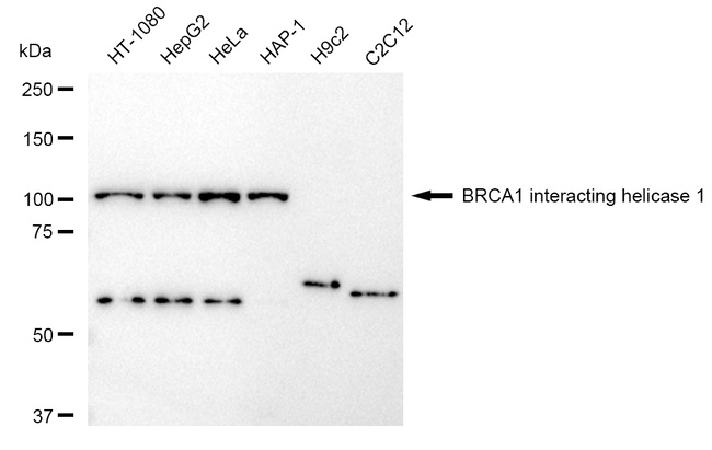 BRIP1 Antibody in Western Blot (WB)
