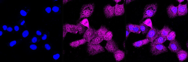 CABP1 Antibody in Immunocytochemistry (ICC/IF)