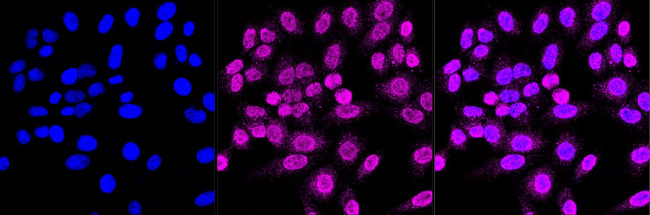 RASSF2 Antibody in Immunocytochemistry (ICC/IF)