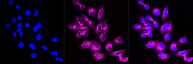 RNF14 Antibody in Immunocytochemistry (ICC/IF)