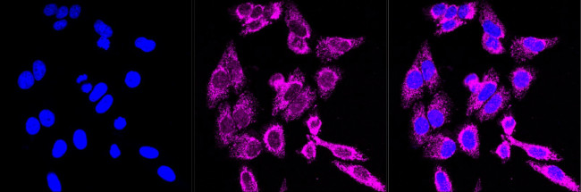MCT1 Antibody in Immunocytochemistry (ICC/IF)