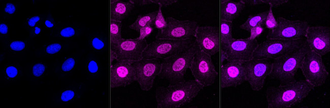 CTR1 Antibody in Immunocytochemistry (ICC/IF)