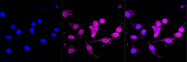 SPOP Antibody in Immunocytochemistry (ICC/IF)